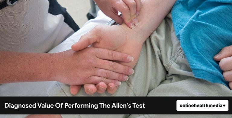 Allen's Test - Physical Examination Of Arterial Blood Flow To The Hands