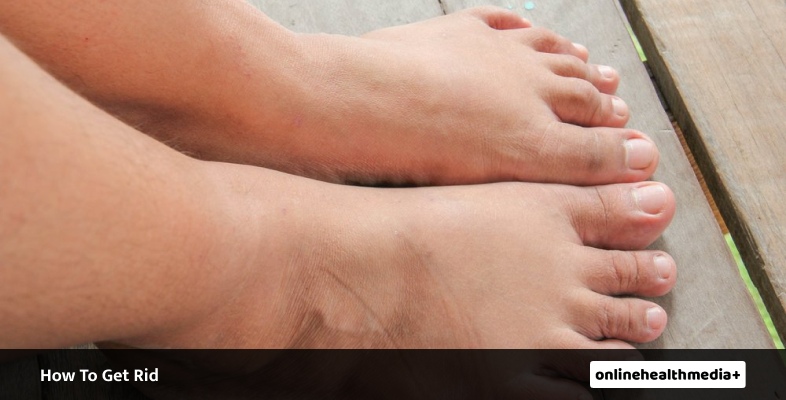 How To Get Rid Of Cankles