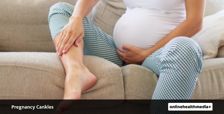 How To Get Rid Of Pregnancy Cankles 