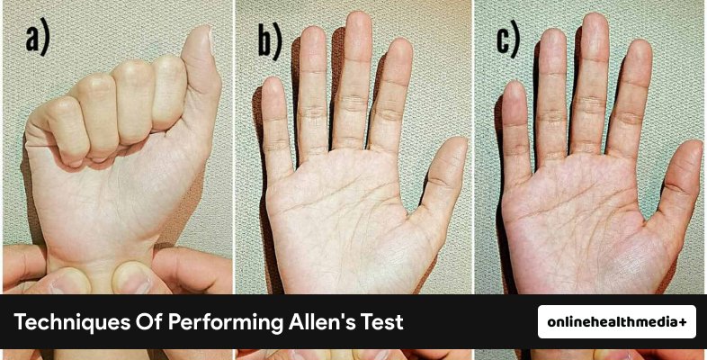 Techniques Of Performing Allen's Test