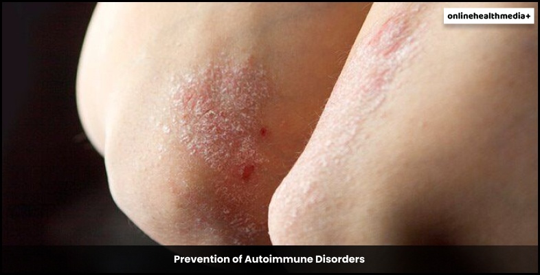 Prevention of Autoimmune Disorders