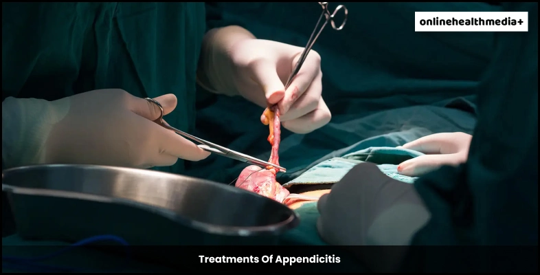 Treatments Of Appendicitis