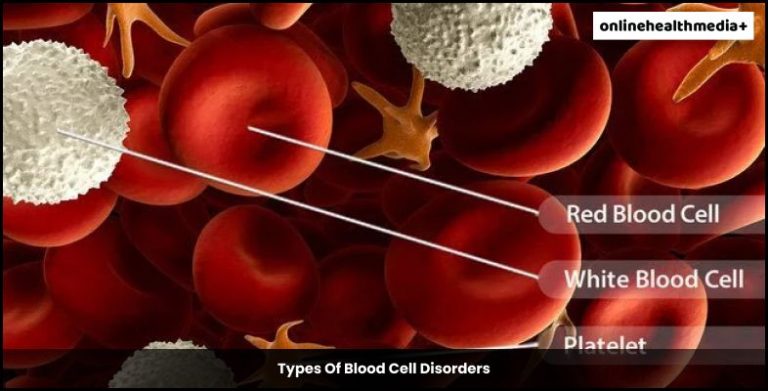 What Are Blood Cell Disorders? Symptoms, Treatment, And Prevention
