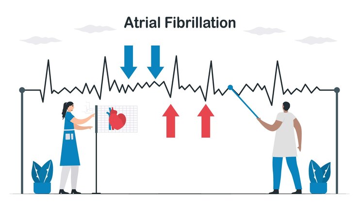  Atrial Fibrillation Treatments