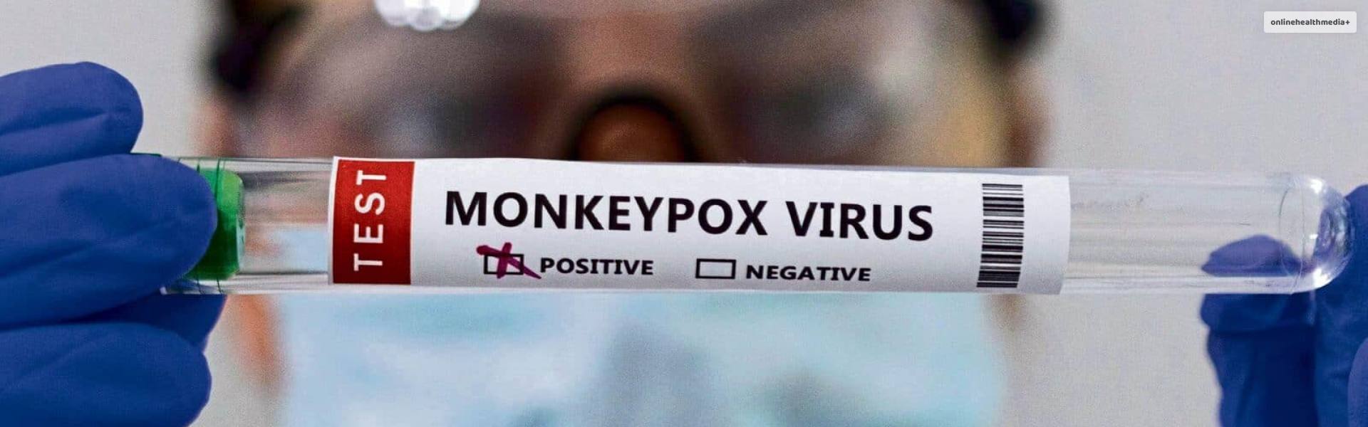 Monkey Pox Affected Numbers Slowly Rising In India