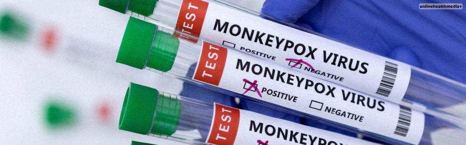 Monkeypox Now Spreads Through Touch