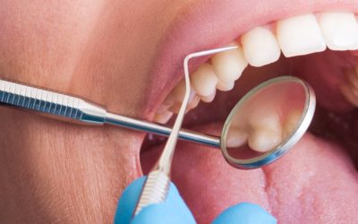 signs of infection after root canal