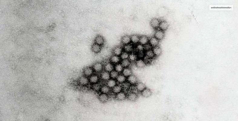 Norovirus Michigan