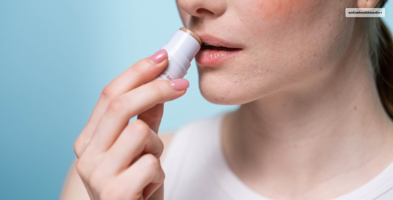 How To Treat Eczema On Lips
