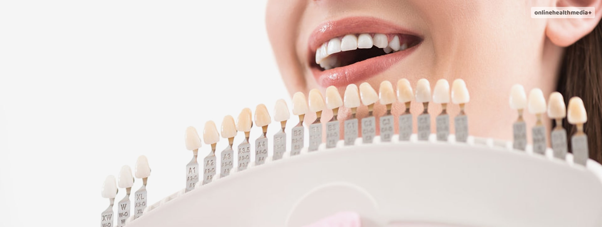 how much do veneers cost