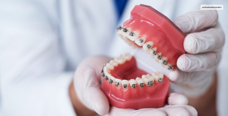 What To Do When Braces Hurt?  
