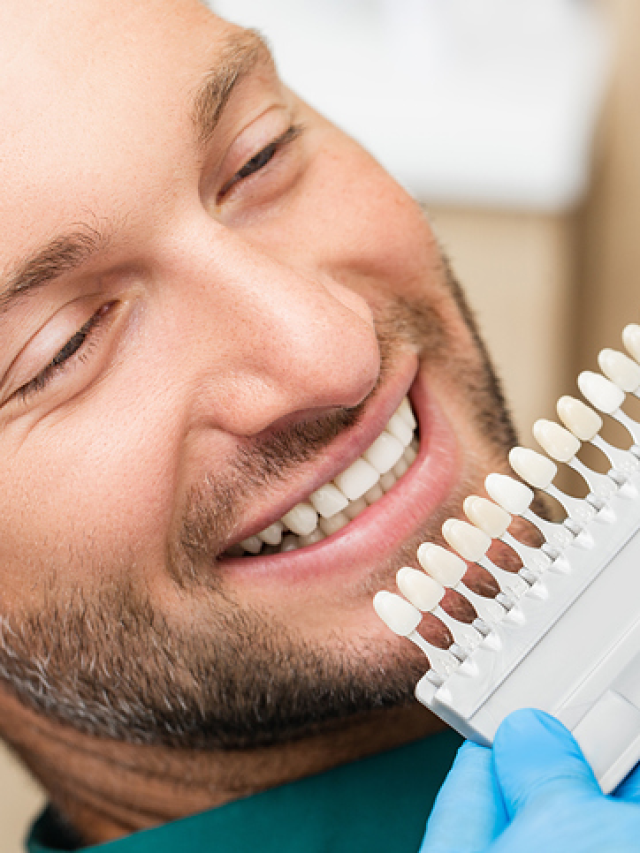 How Much Do Veneers Cost? Can You Afford Them In Your Area? Online
