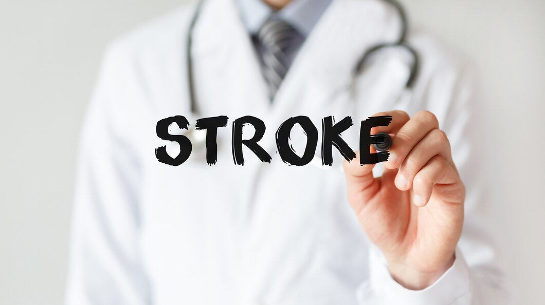 Know About Silent Stroke