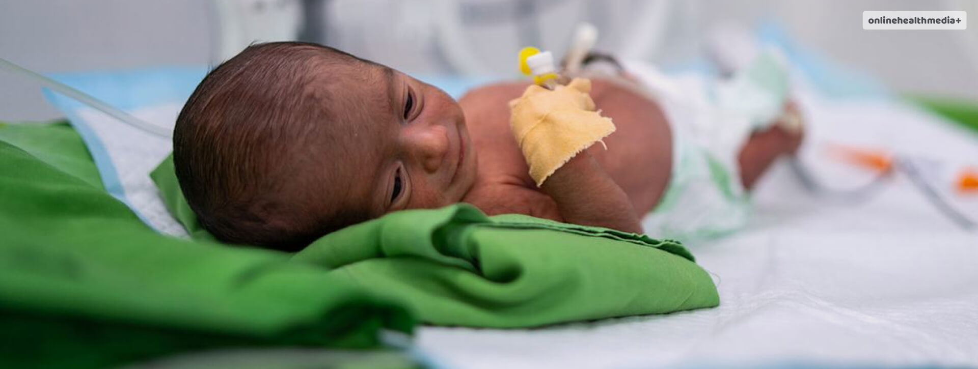High Number Of Preterm Births Linked To Poor Maternal Health And Malnutrition