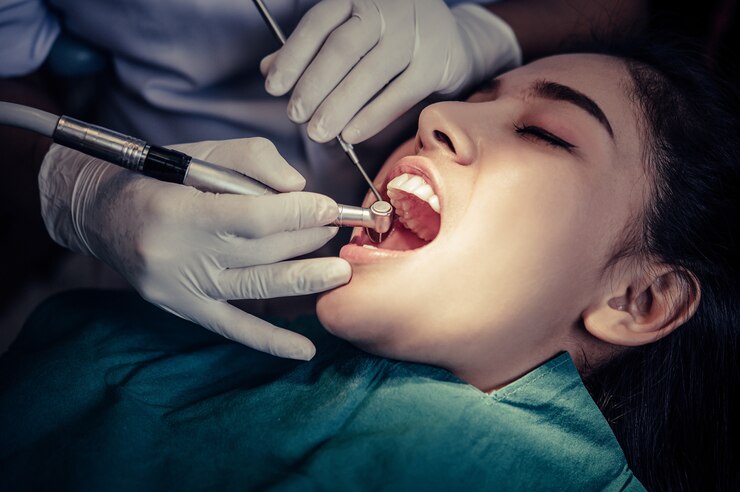 Benefits Of Tooth Fillings 