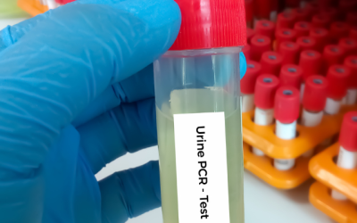 Protein In Urine