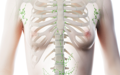 Thoracic Outlet Syndrome