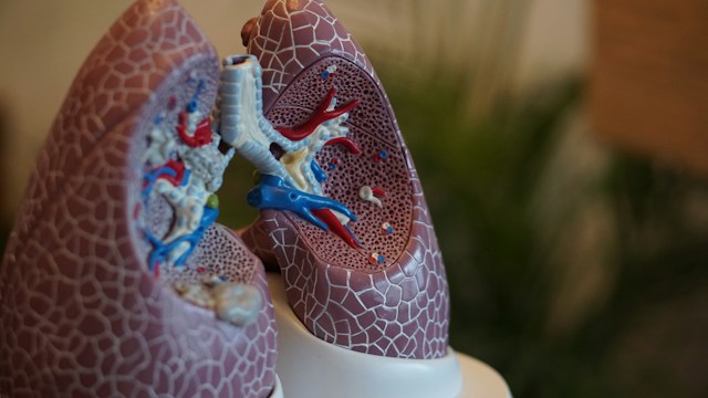 Mesothelioma vs. Lung Cancer